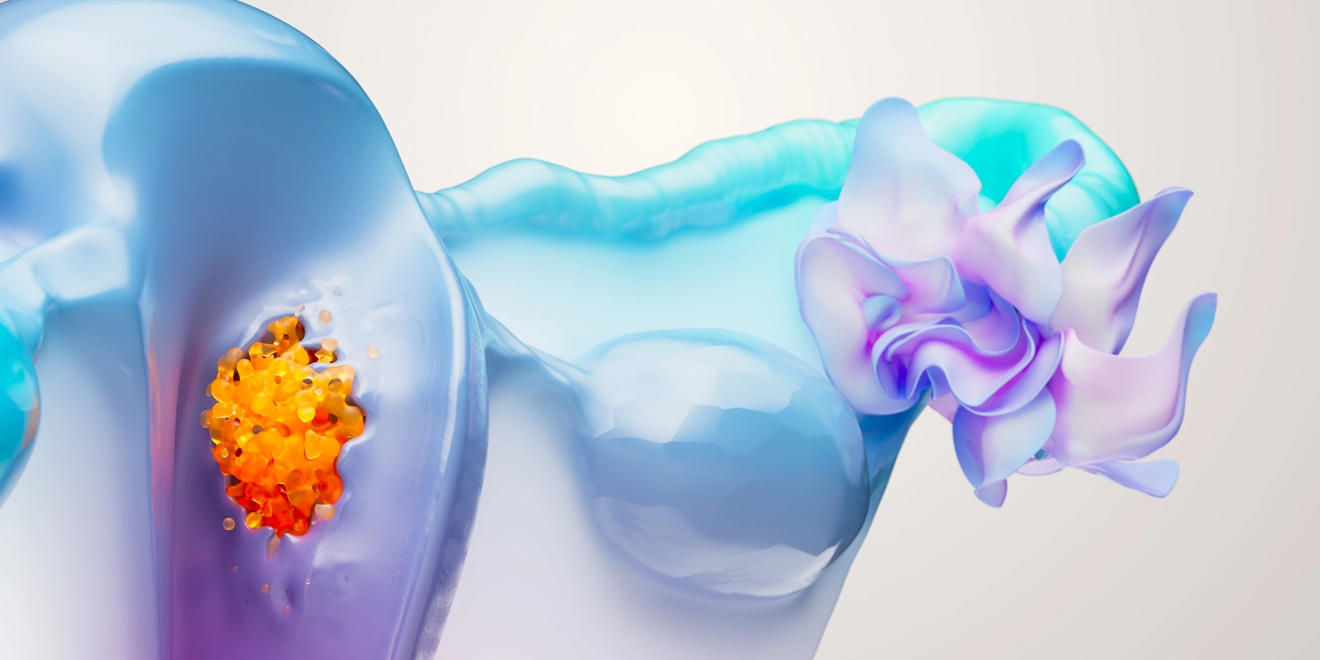 Endometrial illustration