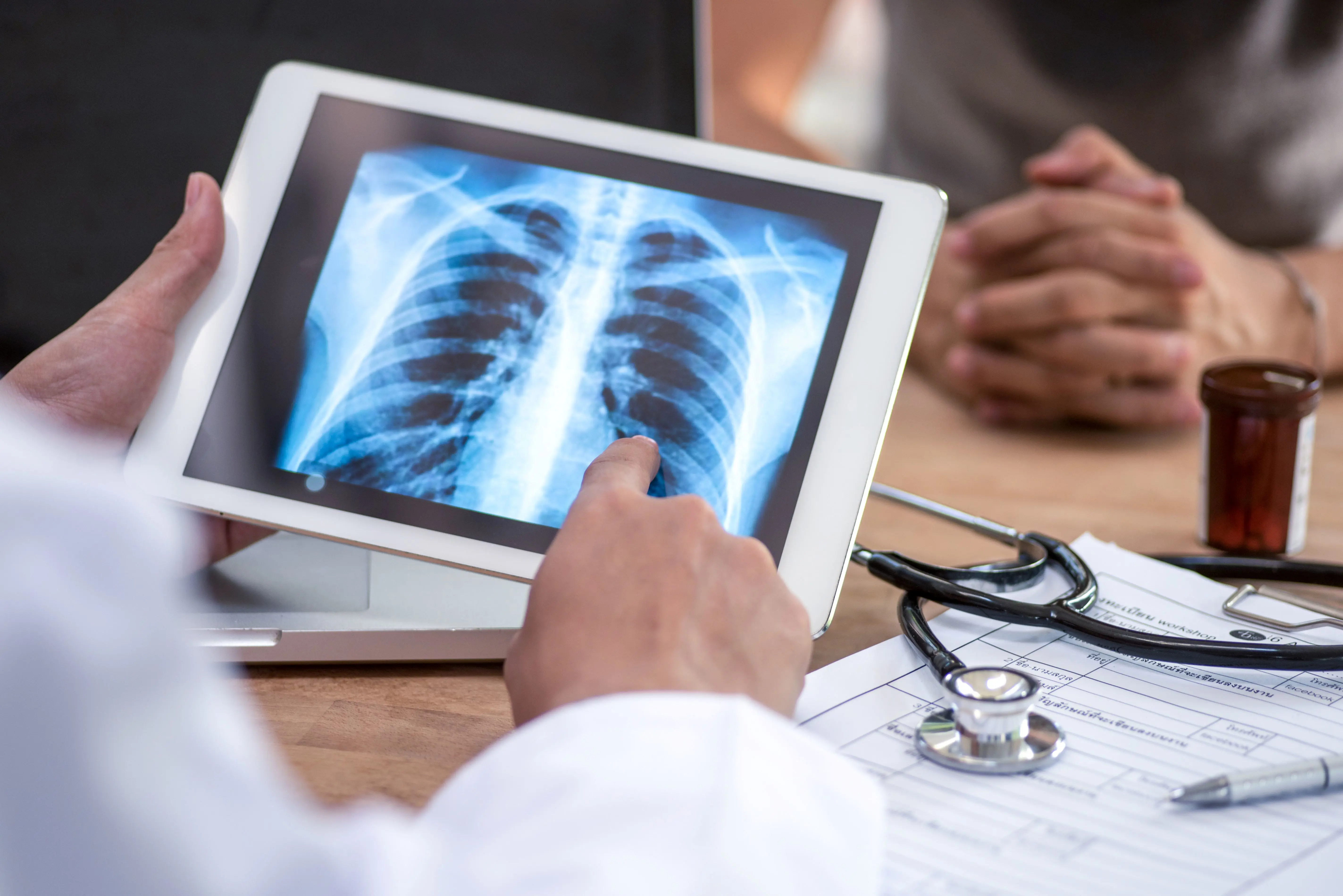 Person points to X-ray image of lungs