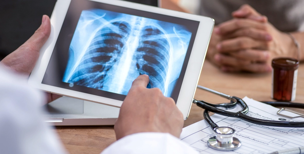 Person points to X-ray image of lungs